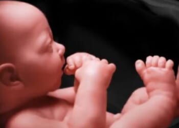 Reflections on the anniversary of Roe v. Wade * WorldNetDaily * by Jerry Newcombe