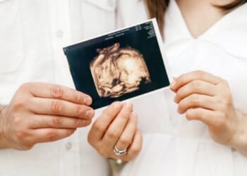 Trump ends use of human fetal tissue in federally funded research * WorldNetDaily * by Bob Unruh
