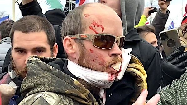 A protester is bloodied from injuries during the mayhem at the U.S. Capitol on Jan. 6, 2021. (Video screenshot)