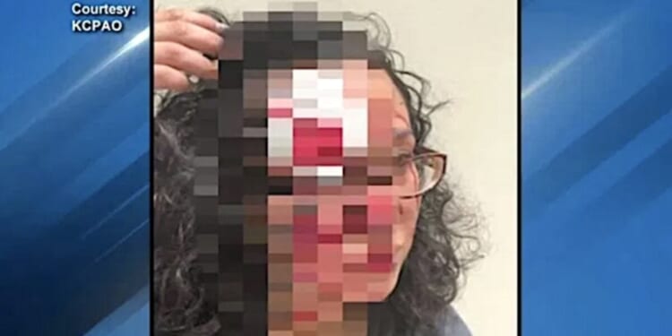Watch as female ‘zombie’ takes chunk of flesh out of another woman * WorldNetDaily * by Joe Kovacs