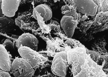 What about the plague? * WorldNetDaily * by Jane M. Orient, M.D.