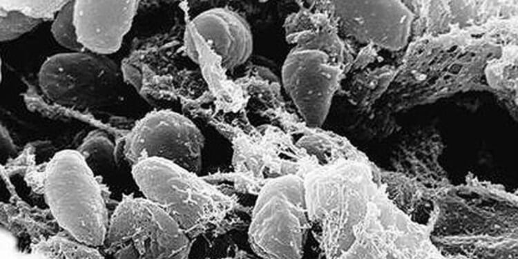What about the plague? * WorldNetDaily * by Jane M. Orient, M.D.